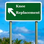 Signs of Needing Knee Replacement